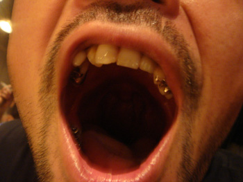 b5.jpg